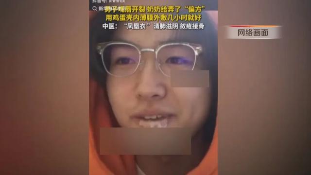 男孩嘴唇开裂奶奶给整了个偏方