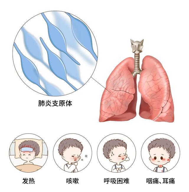 深圳連續(xù)兩周流感中風(fēng)險(xiǎn) 病毒活躍需警惕