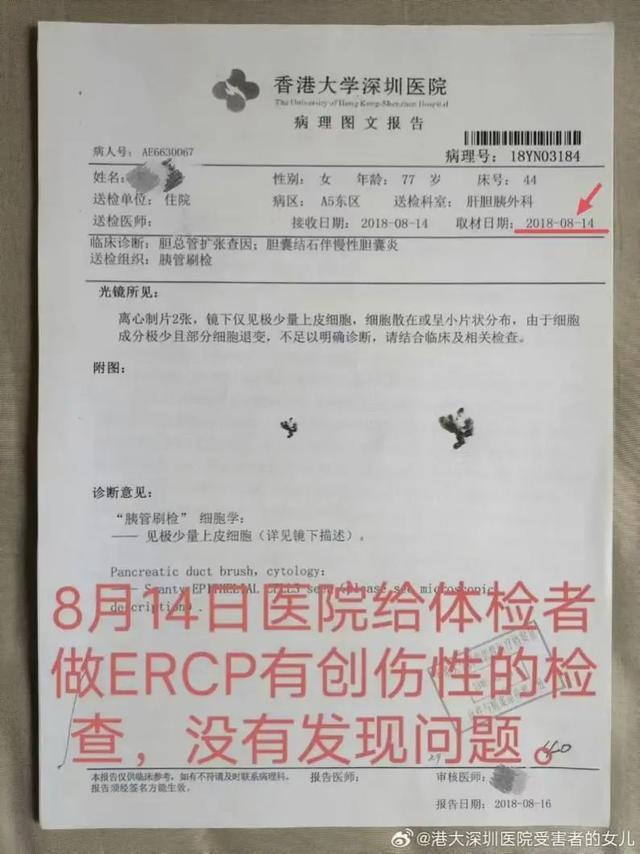 老人被误诊患癌 切除5个器官后离世！