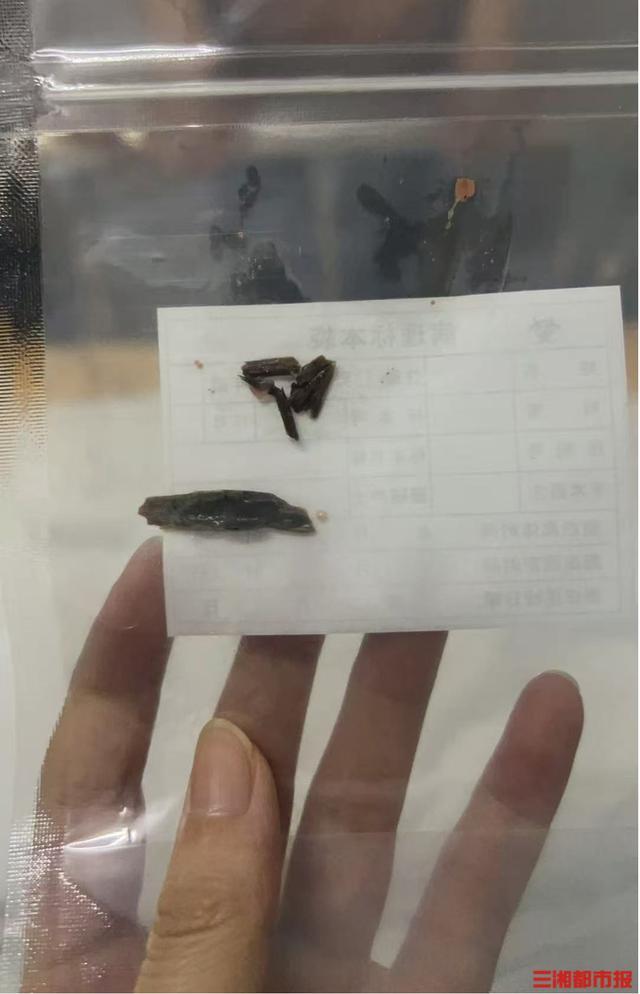 女子走路腿就痛發(fā)現(xiàn)藏體內(nèi)16年竹簽 異物“蟄伏”引發(fā)警覺