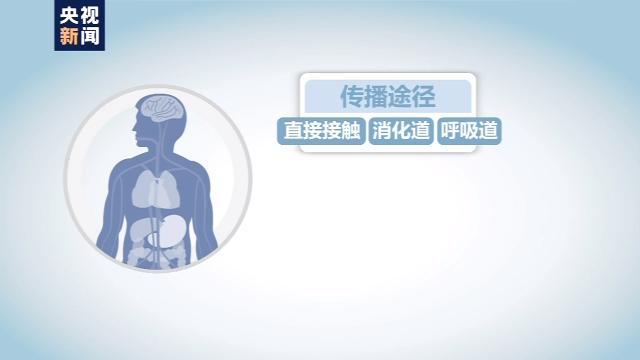 網(wǎng)購羊初乳得布病 醫(yī)生：或引發(fā)終身關(guān)節(jié)損傷……