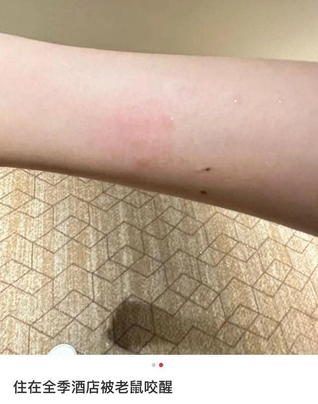 女子入住全季酒店半夜被老鼠咬醒