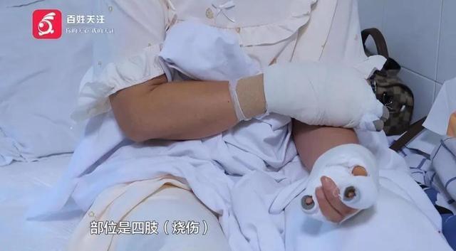 河邊撿石自燃致燒傷 夏日玩水需謹慎