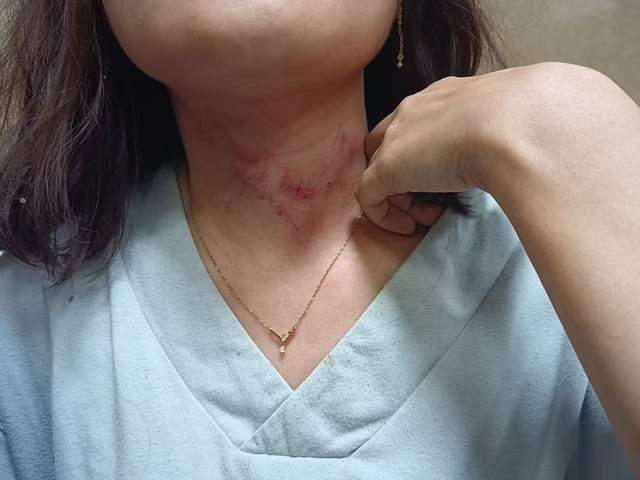 男子凌晨听到呼救发现一女子被勒昏 勇敢市民拍视频吓退歹徒