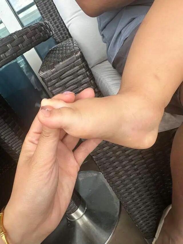 婆孙泳池边被毒虫咬伤索赔酒店遭拒 酒店态度强硬拒绝赔偿