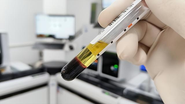 湖北一男子因冠心病去世,生前长期吃他汀,为什么病还是恶化了 综合风险管理的重要性