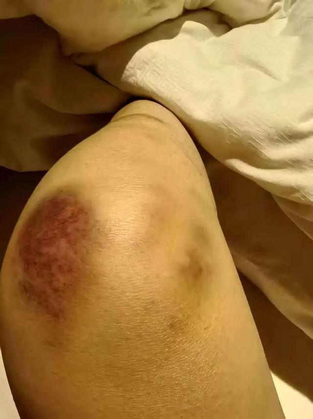 男子在离婚冷静期毒杀儿子和女儿 悲剧背后的极端控制欲