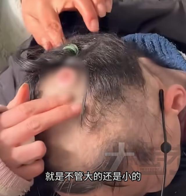 父亲1天干20个小时筹钱救患癌女儿 全家拼尽全力