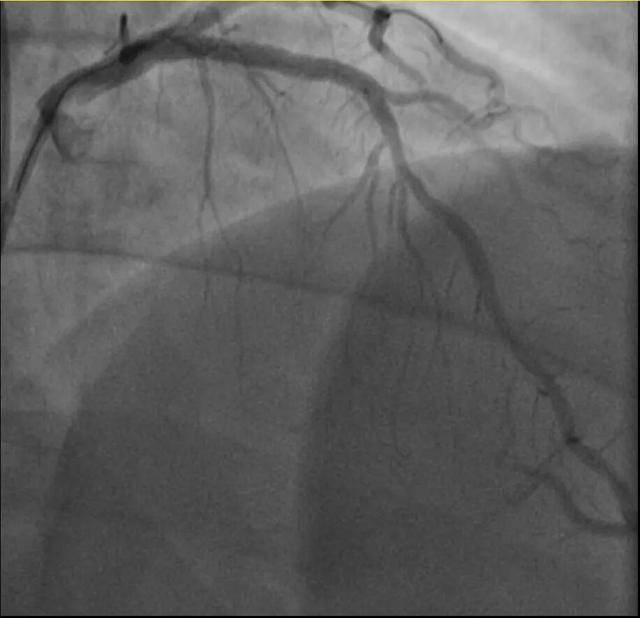 一天内,杭州两位38岁宝爸运动后倒下!医生:这些都是导火索!剧烈运动需谨慎