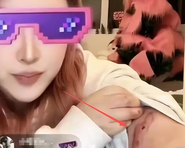 百万网红因荒原病被诬陷二十五年 人命警钟长鸣