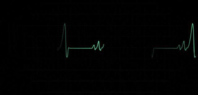 记者：张雪峰生前跑步出现不适送医 心源性猝死夺命