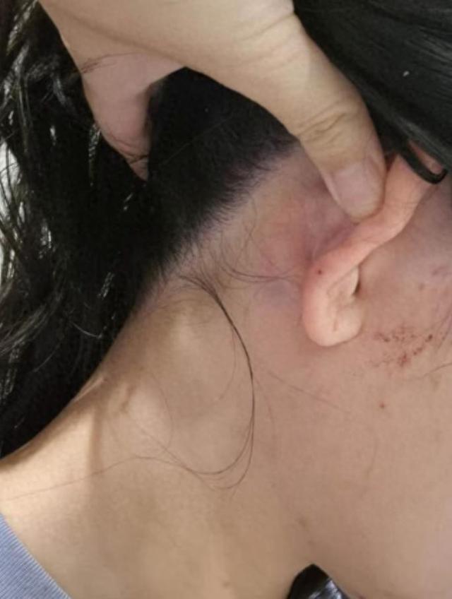 女子在澳遭小孩挑衅后被其母殴打