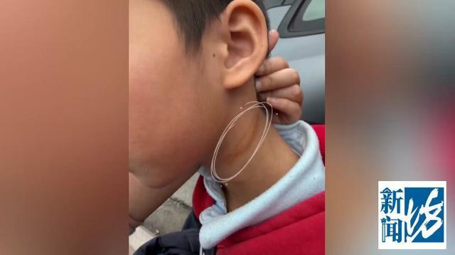 妈妈称带儿子看病被医生掐脖掌掴 医患冲突引关注