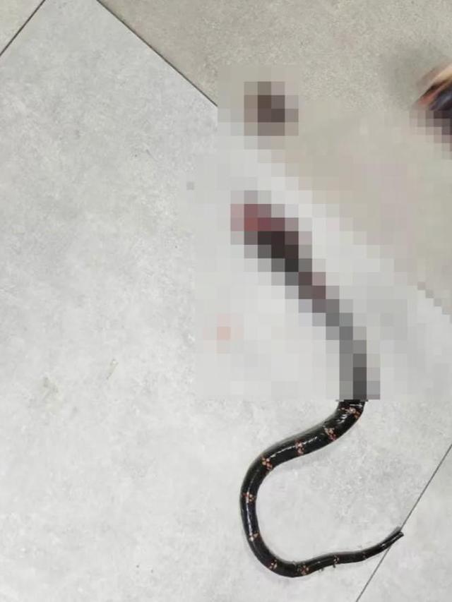 村民被毒蛇咬伤 3天用13支血清救活 昭通首例眼镜王蛇咬伤成功救治