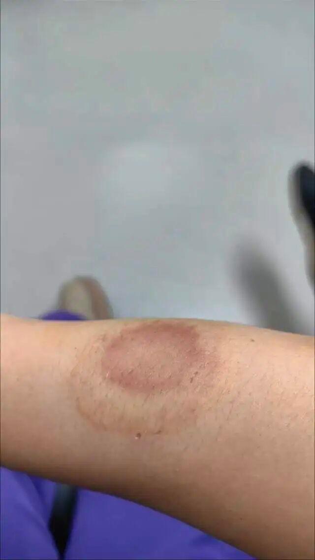 女子写字条提醒邻居 遭对方撬锁殴打 因垃圾问题引发冲突