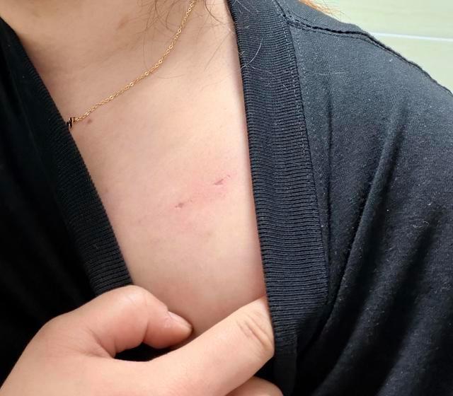 女子称洗澡遭醉酒男闯入欲行不轨 案件仍在继续侦办中