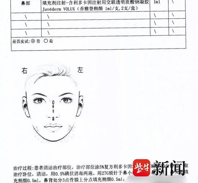 女子花2萬(wàn)隆鼻 玻尿酸從鼻孔流出 醫(yī)美機(jī)構(gòu)賠償數(shù)萬(wàn)元