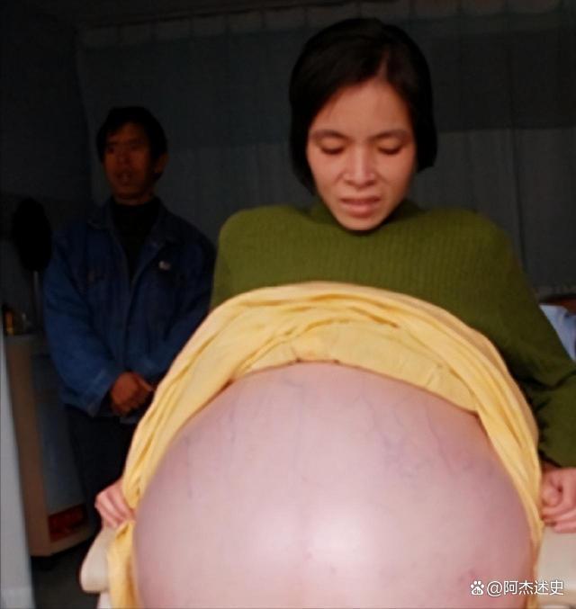 女子陪诊被医生看出异常 查出肿瘤