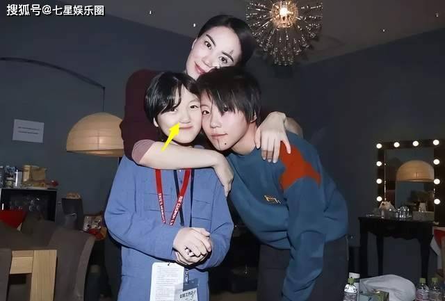 李嫣公开术后照片，4次手术摆脱兔唇，颜值赛王菲，美出新高度