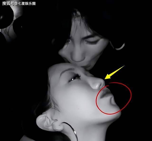 李嫣公开术后照片，4次手术摆脱兔唇，颜值赛王菲，美出新高度