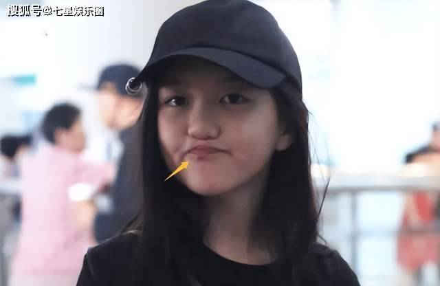 李嫣公开术后照片，4次手术摆脱兔唇，颜值赛王菲，美出新高度