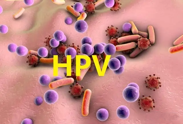 感染了HPV就一定是私生活混乱吗？这些关于HPV的真相每个人都需要了解