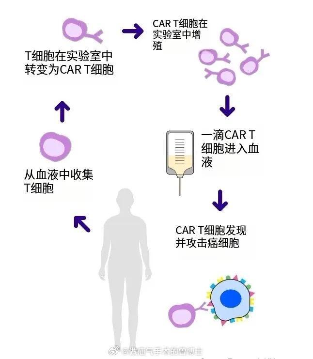 好医保可报国内全部CART疗法 高额治疗费用不再愁