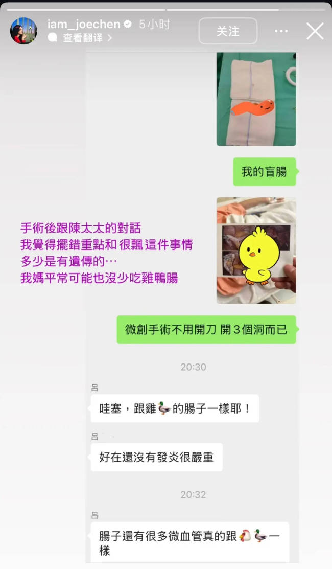 陈乔恩自曝得盲肠炎！为不影响工作当天就做了手术