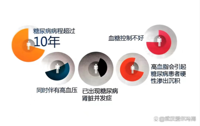 糖尿病患者能吃粽子吗？小心眼部并发症