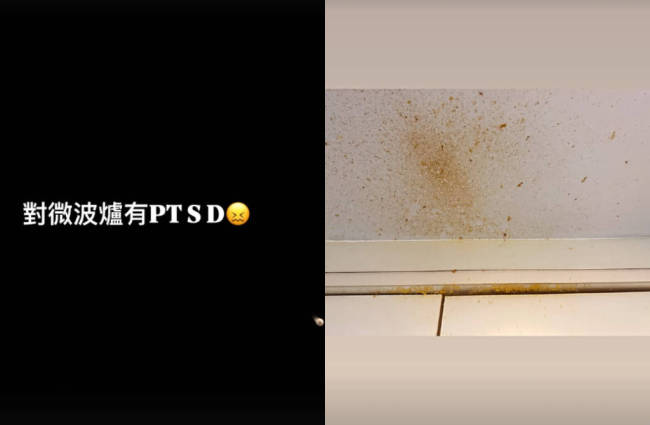 女演员微波炉煮鸡蛋被炸伤眼睛：眼角膜破了个大洞