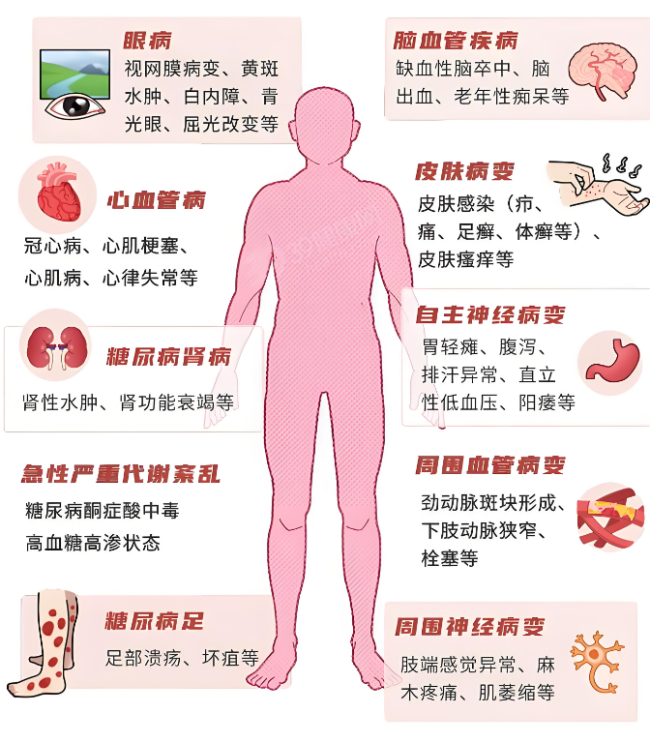 健康中国行动深化推进，山丘联康引领糖尿病管理新篇章