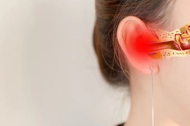 脑梗来临，耳朵发出的3个“警报”，耳鸣、耳聋、耳痛都是！