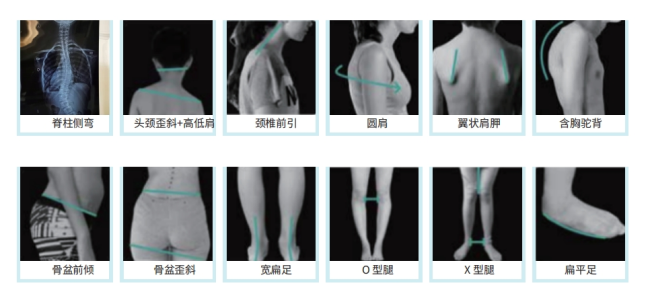 活动预告 | 深圳市宝安区首届脊柱健康日暨世界脊柱健康日公益行动
