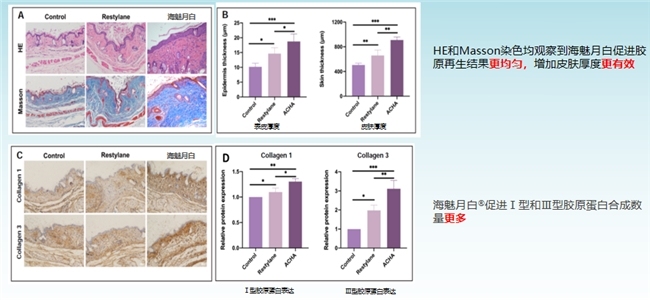 全球首创氨基酸交联玻尿酸“海魅月白”上市　我国生物医用材料领域实现重大突破