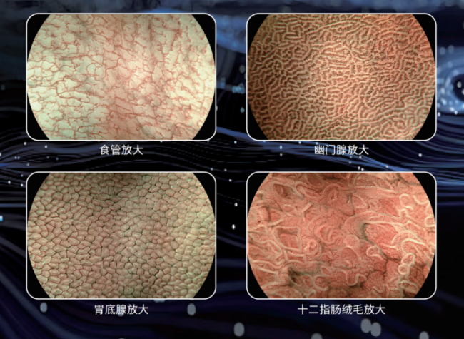 全球首创！科思明德145倍一键自动调焦光学放大内镜：秒级响应让医生专注发现病灶