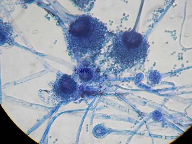 春节后，务必要小心一种霉菌，该霉菌会攻击人的脑肝肾心