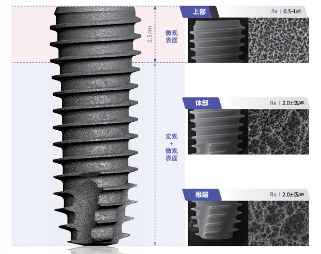 DIO种植体型号怎么选？亲水与非亲水种植体的区别与参考