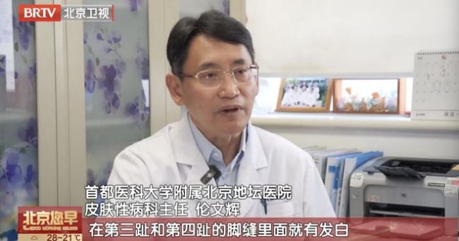 “网红”鞋子竟导致脚臭、真菌感染！已有多人中招！
