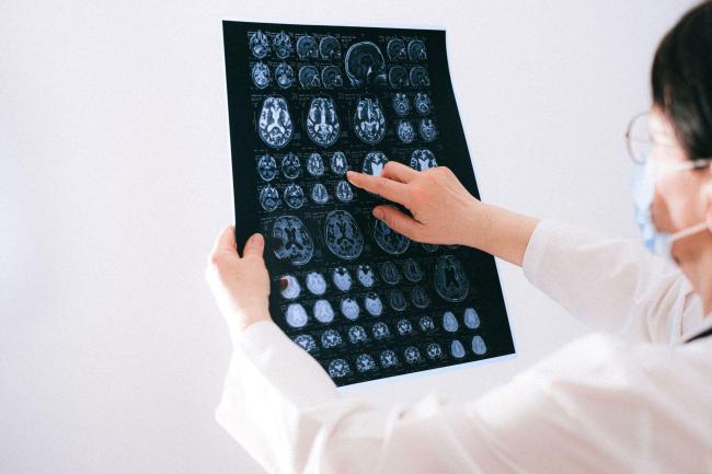 驾驭“脑电风暴”:加州大学洛杉矶分校医疗中心(UCLA Health)癫痫前沿护理方案