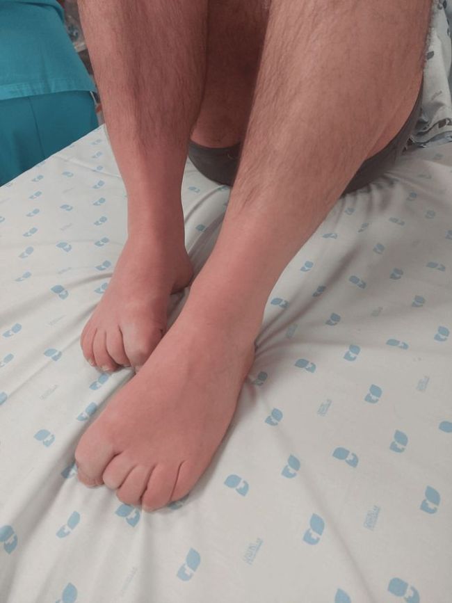2块榴莲配4两白酒，随后进ICU抢救？那些看不见的“头孢配酒”