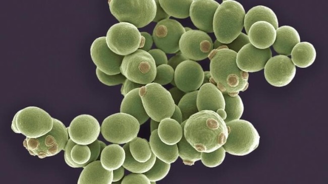阿根廷首现超级真菌感染病例 最早于2009年在日本首次被发现