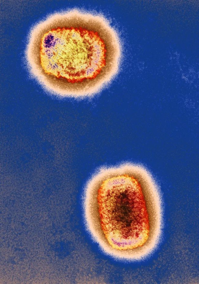 已出现人际传播，猴痘会大流行吗？