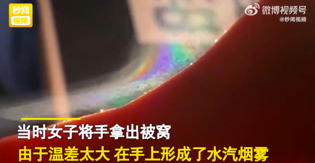 女子轻微发热在被子捂汗手伸出被子竟意外发现“彩虹” 原因真的太神奇