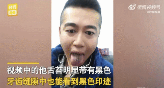 男子确诊后舌头牙齿全变黑，一查吓一跳：还有这副作用
