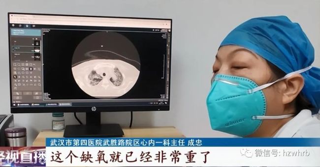 70岁老太没高烧不咳嗽，一查竟“白肺”！医生提醒：老人阳了，这几方面要加强监测