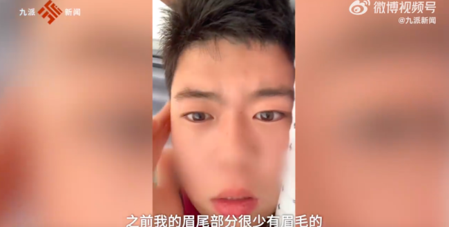 小伙阳后眉毛头发迅速增长