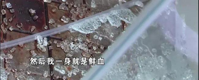 浴室门爆裂伤手 男子三万月薪受影响：缝了二十多针