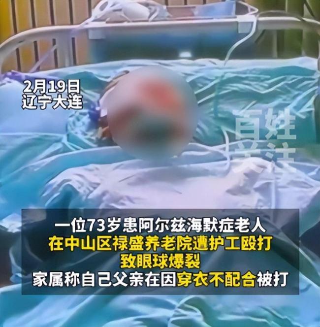 警方调查大连一老人被打 殴打导致眼球破裂右眼失明  