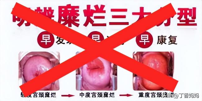 都有哪些专坑女性的妇科骗局 一文读懂防止上当受骗