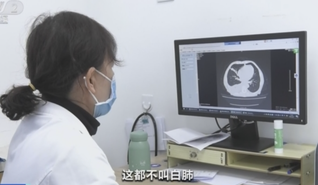 流感患者得白肺的比例较低